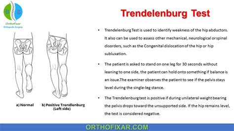 hip drop test|trendelenburg gait nerve damage.